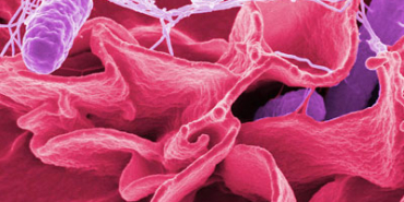 GIDADA SALMONELLA ŞOKU!